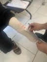 Oficina Ortopédica de Bagé está realizando medição de órtese e próteses